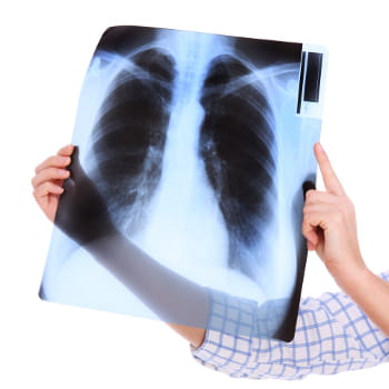 un cliché radiographique est recouvert de sels d'argent, qu'il faut récupérer