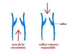 valves