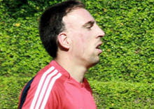 franck ribéry est resté marqué au visage par l'accident.